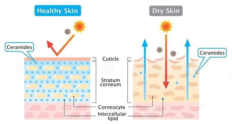 mặt nạ dưỡng ẩm cho da khô nhạy cảm